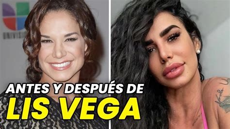 lis vega antes y después|5 FOTOS de Lis Vega que muestran su RADICAL cambio